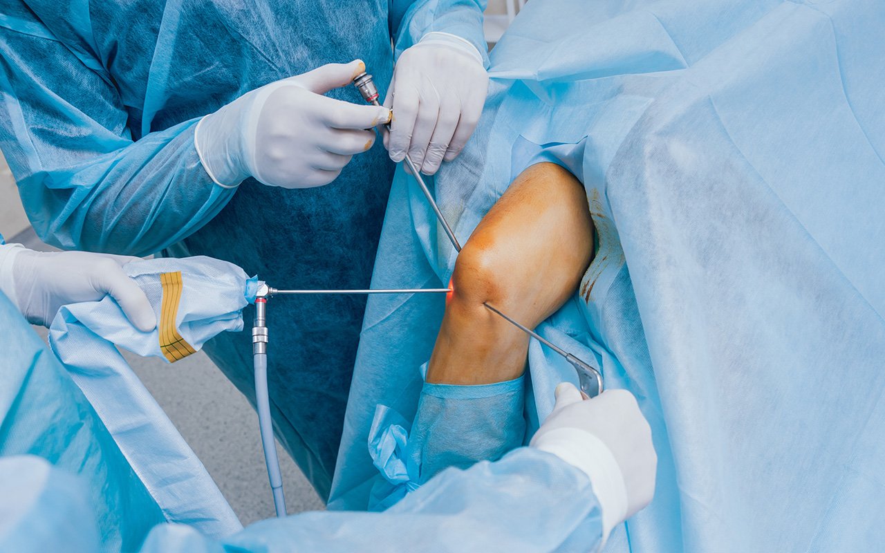 Knee Arthroscopy In Nagpur