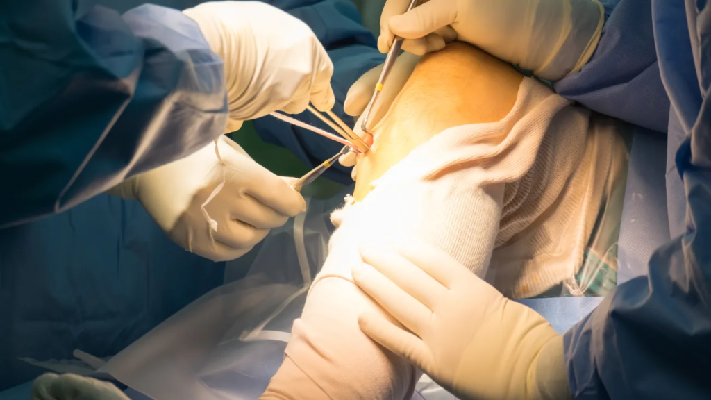 ACL Surgeon In Seoni