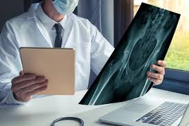 Hip Specialist in Nagpur