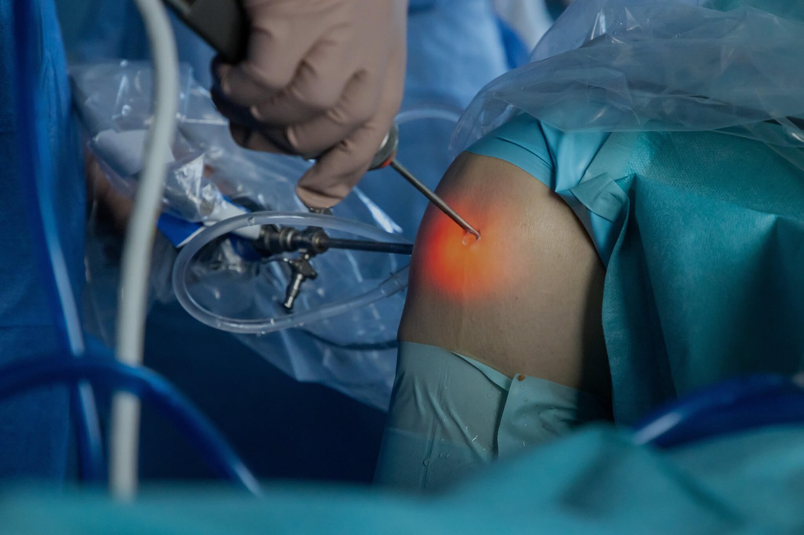 Laser Knee Surgeon In Rewa