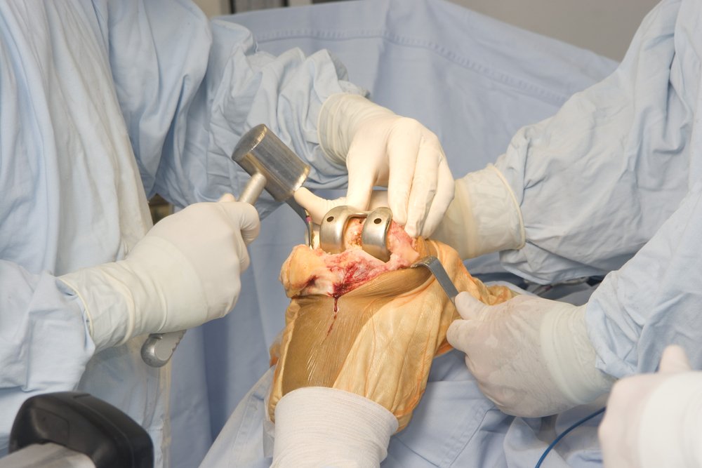Orthopedic Doctors near me