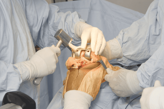 Orthopedic Surgeon In Nagpur