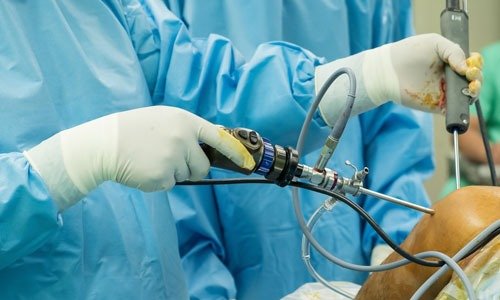 Shoulder Arthroscopy In Chhindwara