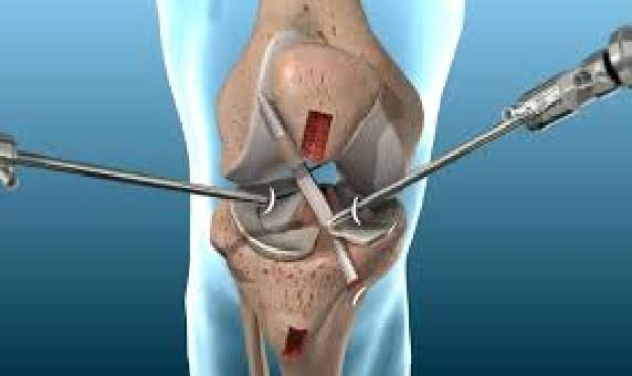 ACL Surgeon In Adilabad
