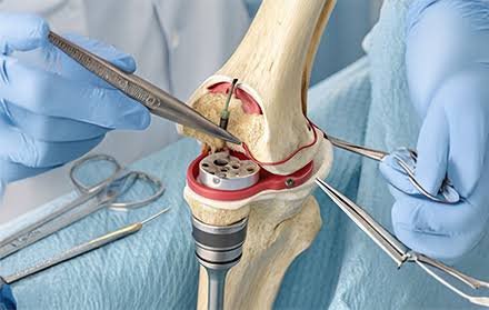 Knee Replacement Surgeon In Adilabad