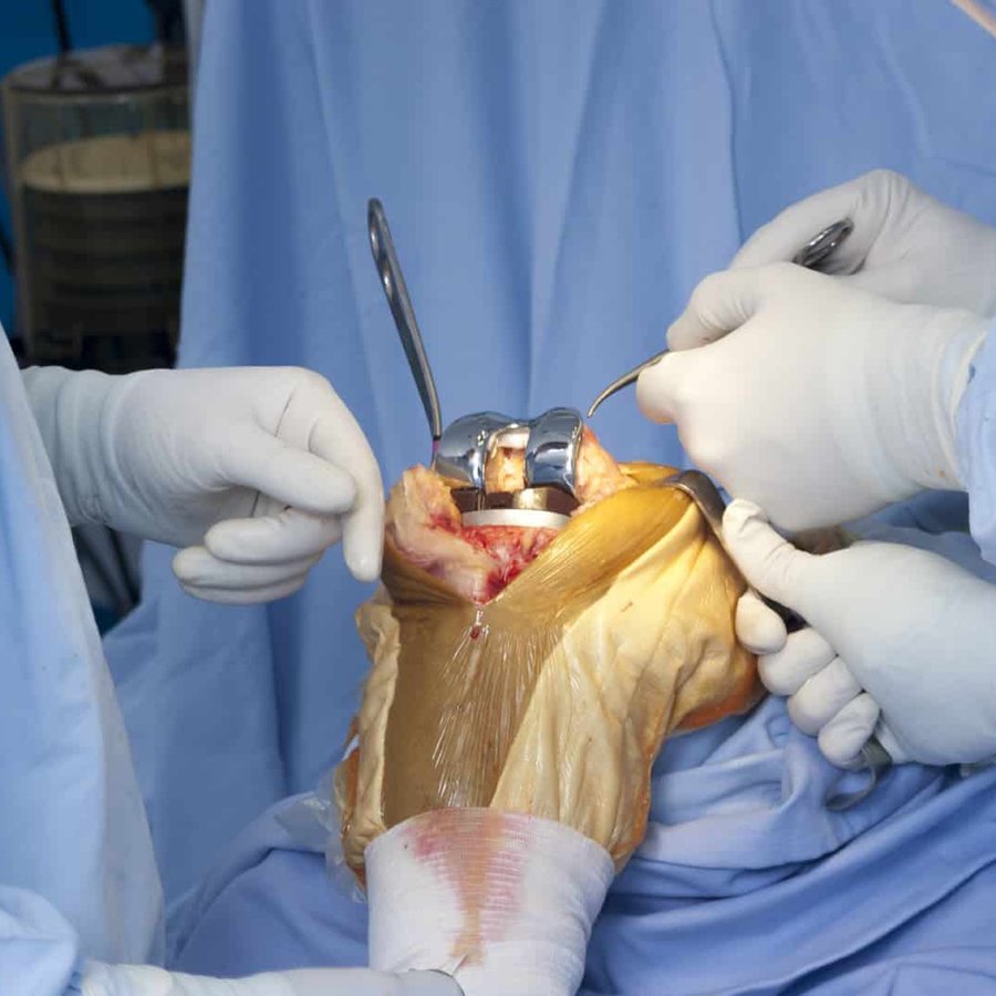 Knee Replacement Surgeon In Chhindwara